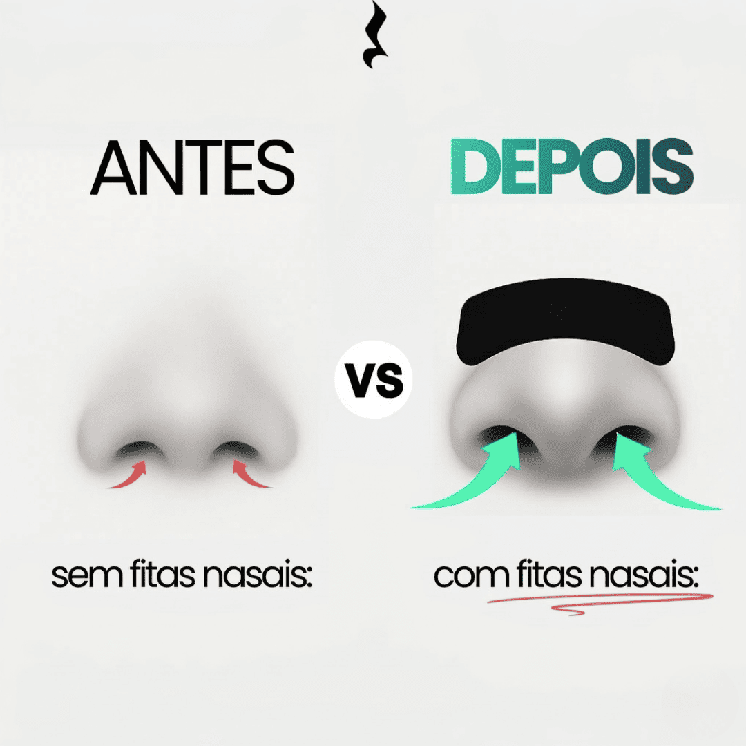 Nasal Strips