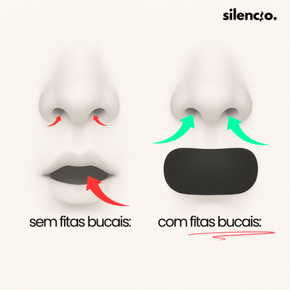 Silencio Mouth Tape ™ - Silencio