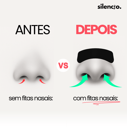 Silencio Nasal Tape ™ - Silencio